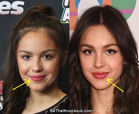 did olivia rodrigo get breast implants|Olivia Rodrigo, Before and After